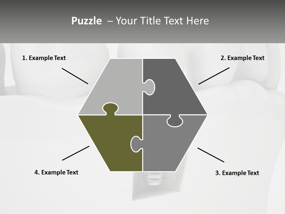 A Tooth With A Dental Implant On Top Of It PowerPoint Template