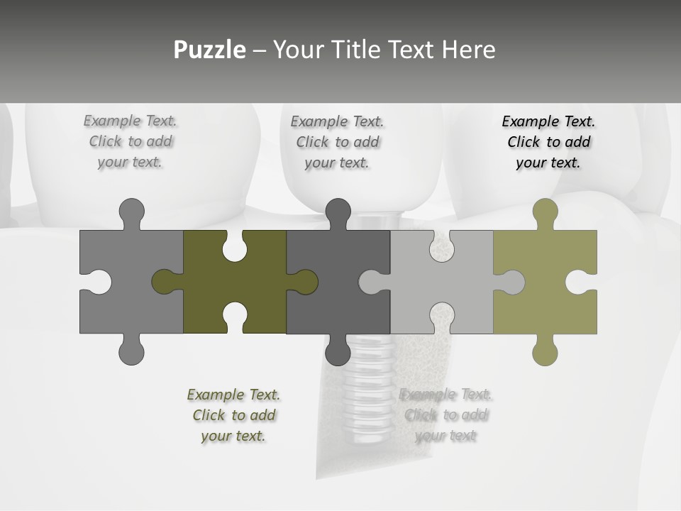A Tooth With A Dental Implant On Top Of It PowerPoint Template