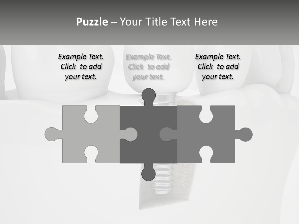 A Tooth With A Dental Implant On Top Of It PowerPoint Template