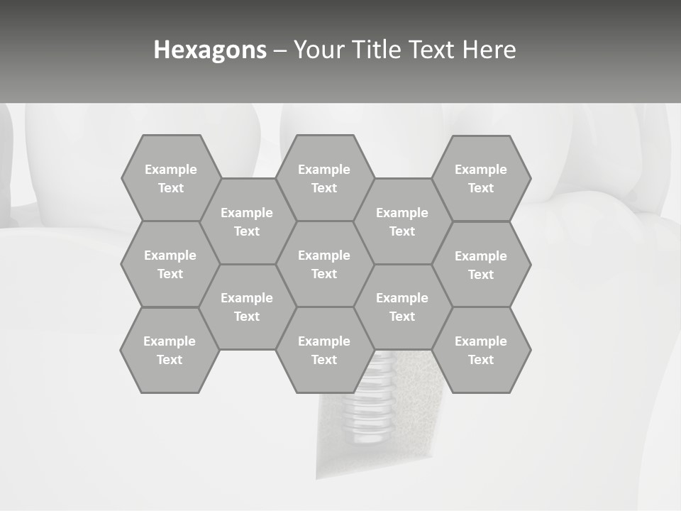 A Tooth With A Dental Implant On Top Of It PowerPoint Template