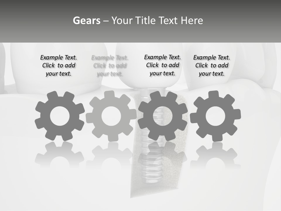 A Tooth With A Dental Implant On Top Of It PowerPoint Template