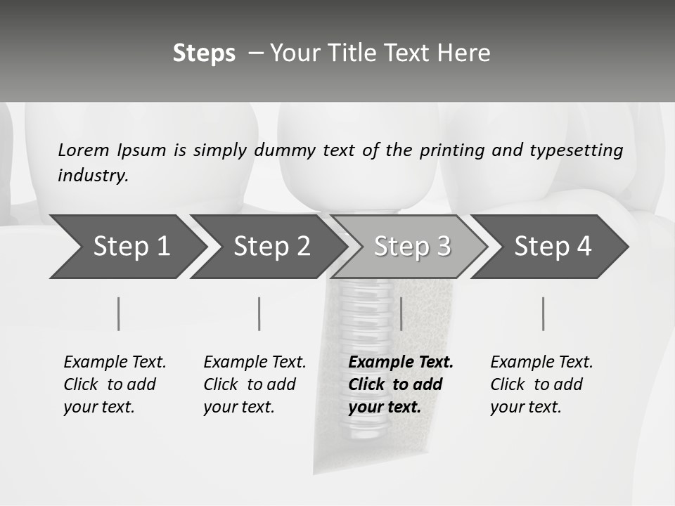 A Tooth With A Dental Implant On Top Of It PowerPoint Template