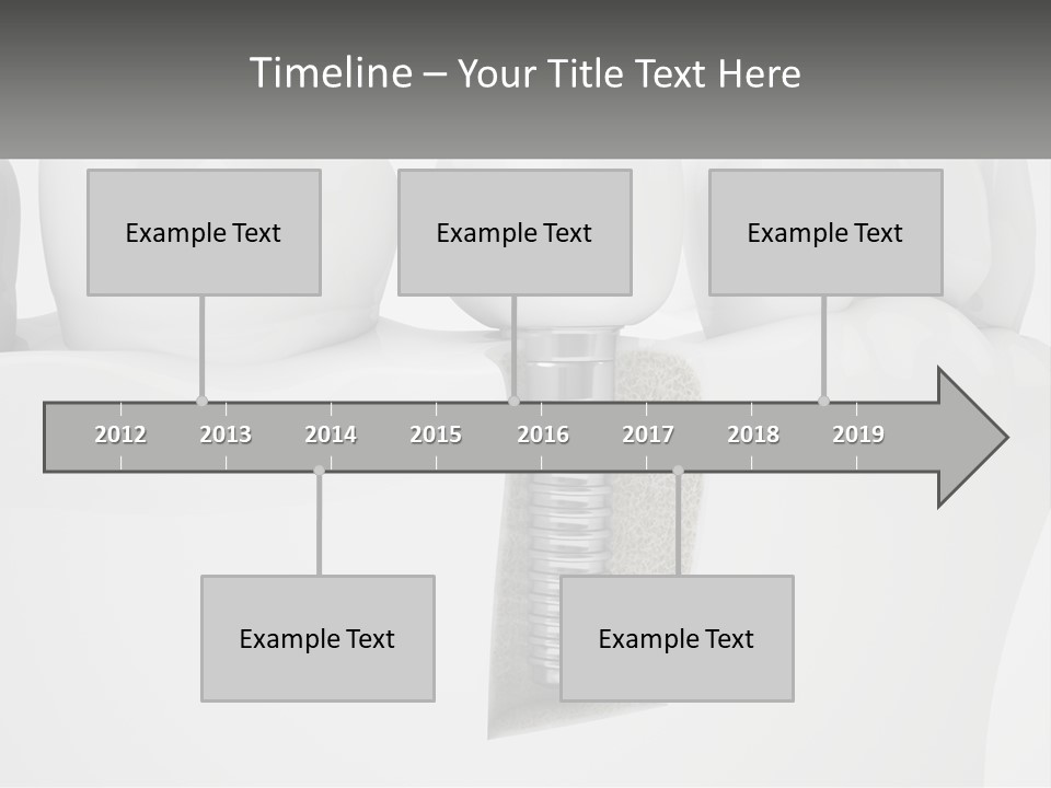 A Tooth With A Dental Implant On Top Of It PowerPoint Template