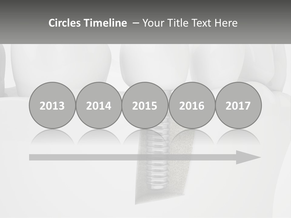 A Tooth With A Dental Implant On Top Of It PowerPoint Template