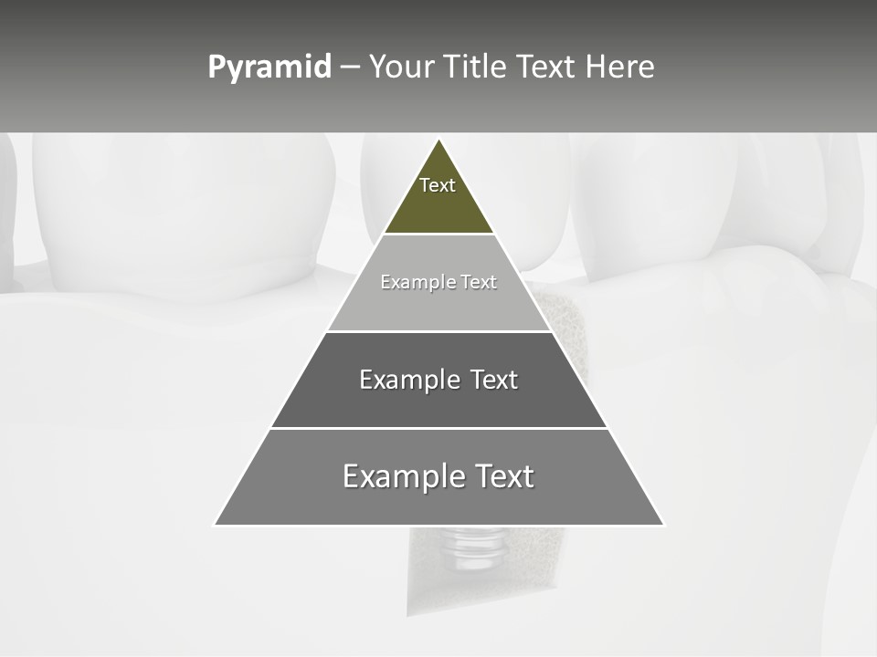 A Tooth With A Dental Implant On Top Of It PowerPoint Template