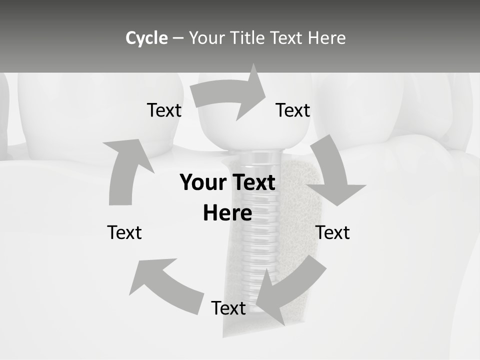 A Tooth With A Dental Implant On Top Of It PowerPoint Template