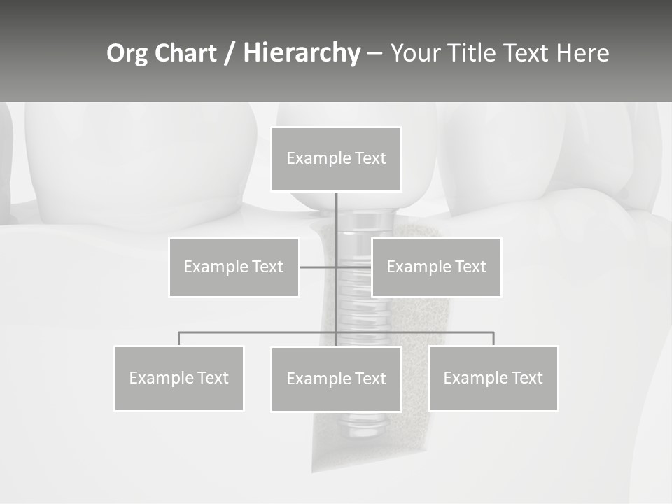 A Tooth With A Dental Implant On Top Of It PowerPoint Template