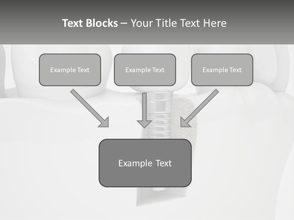 A Tooth With A Dental Implant On Top Of It PowerPoint Template