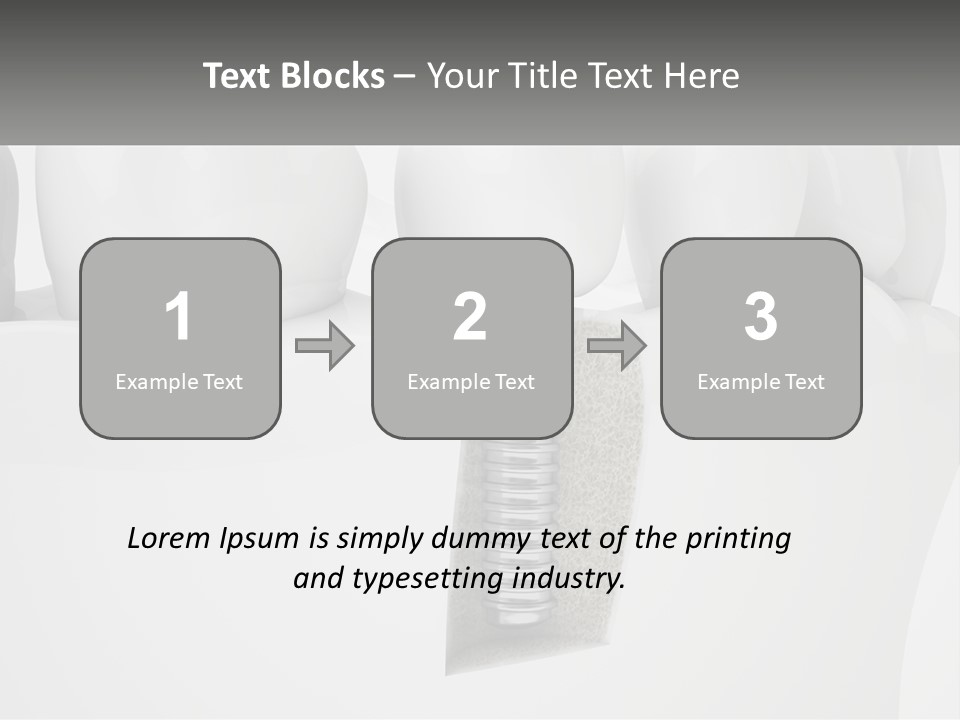 A Tooth With A Dental Implant On Top Of It PowerPoint Template