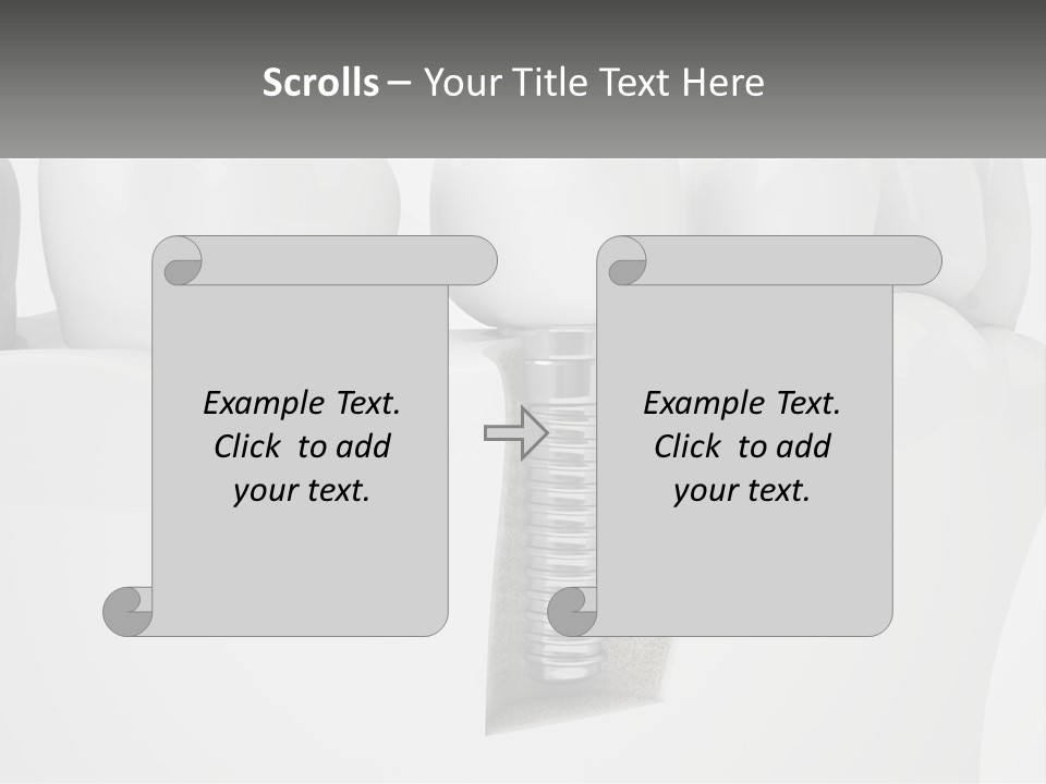 A Tooth With A Dental Implant On Top Of It PowerPoint Template