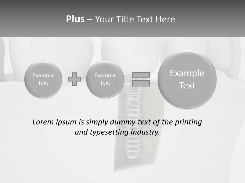 A Tooth With A Dental Implant On Top Of It PowerPoint Template