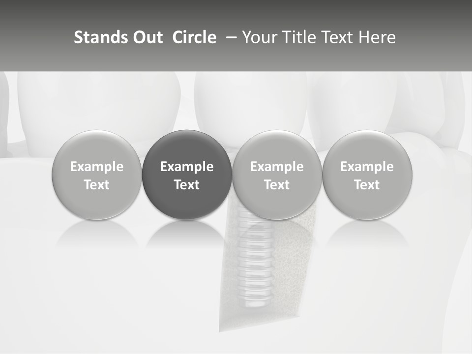 A Tooth With A Dental Implant On Top Of It PowerPoint Template