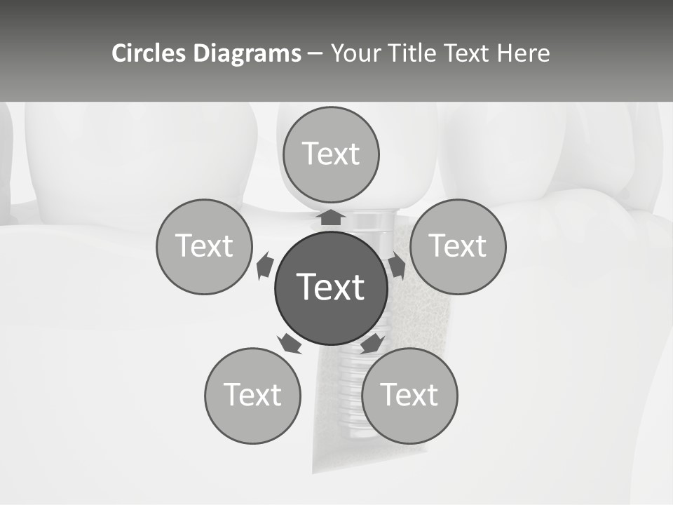 A Tooth With A Dental Implant On Top Of It PowerPoint Template