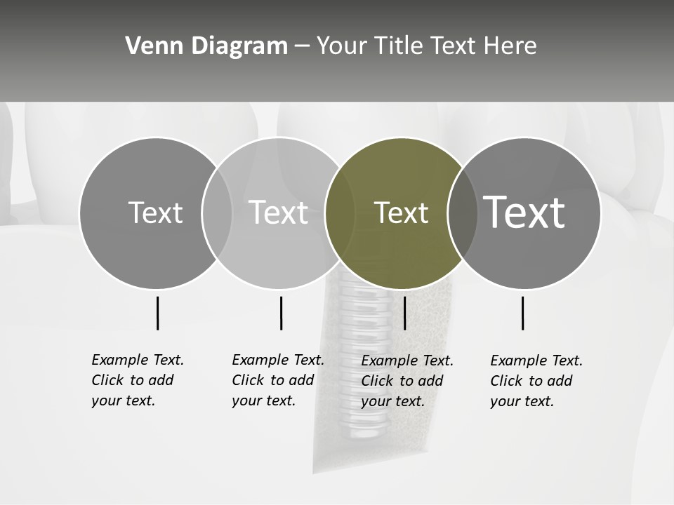 A Tooth With A Dental Implant On Top Of It PowerPoint Template