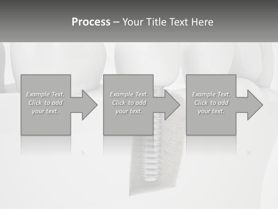 A Tooth With A Dental Implant On Top Of It PowerPoint Template