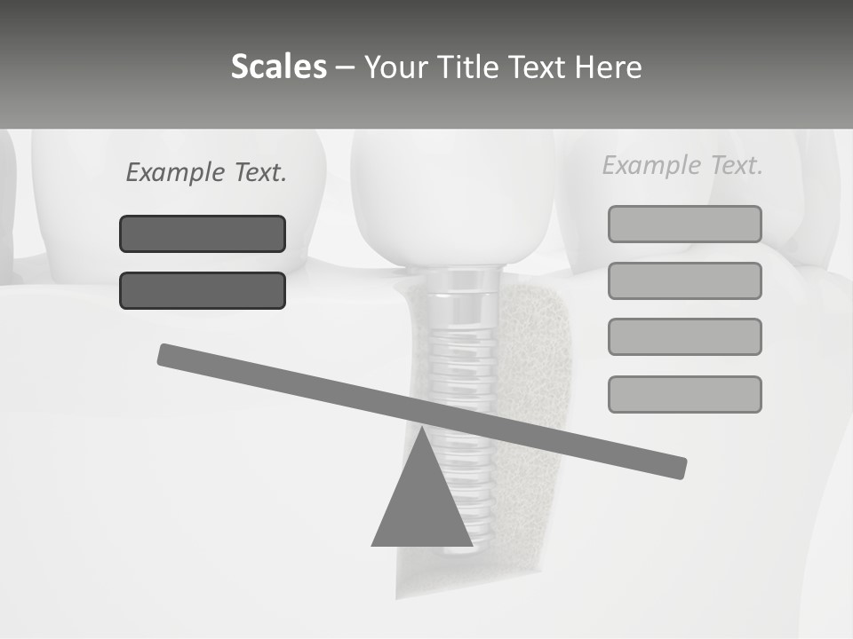A Tooth With A Dental Implant On Top Of It PowerPoint Template