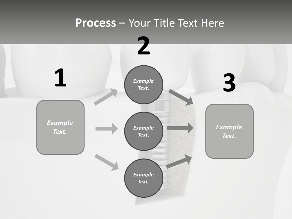 A Tooth With A Dental Implant On Top Of It PowerPoint Template