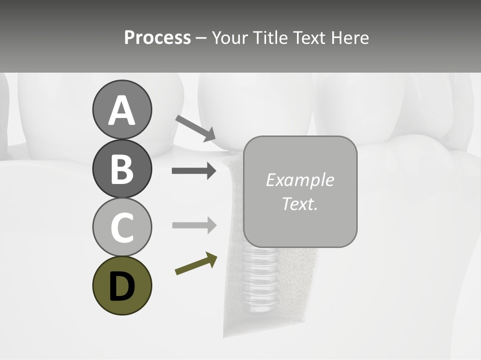 A Tooth With A Dental Implant On Top Of It PowerPoint Template