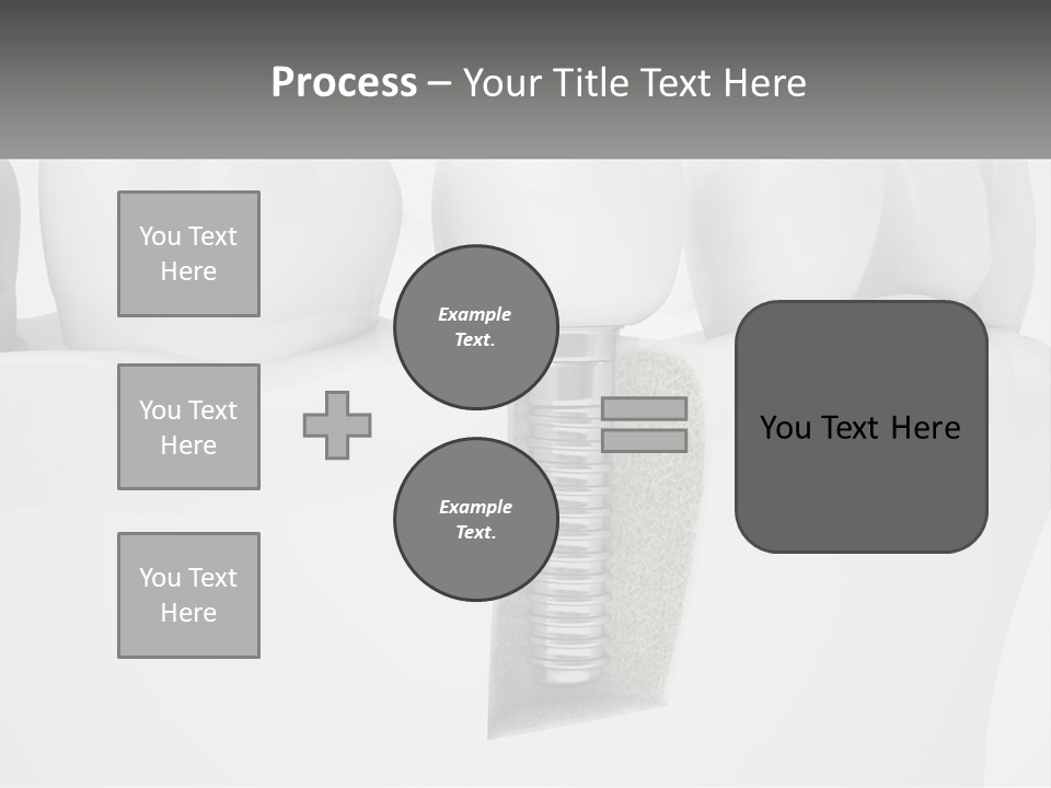 A Tooth With A Dental Implant On Top Of It PowerPoint Template