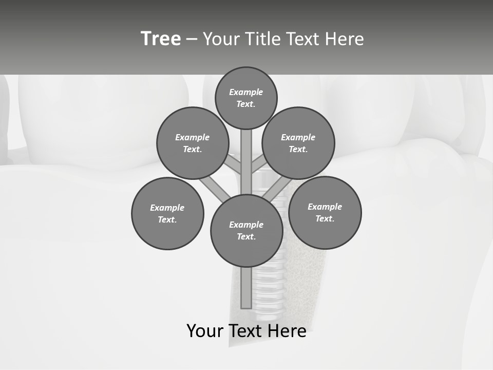 A Tooth With A Dental Implant On Top Of It PowerPoint Template