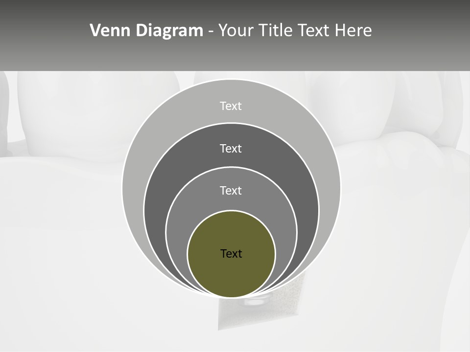 A Tooth With A Dental Implant On Top Of It PowerPoint Template
