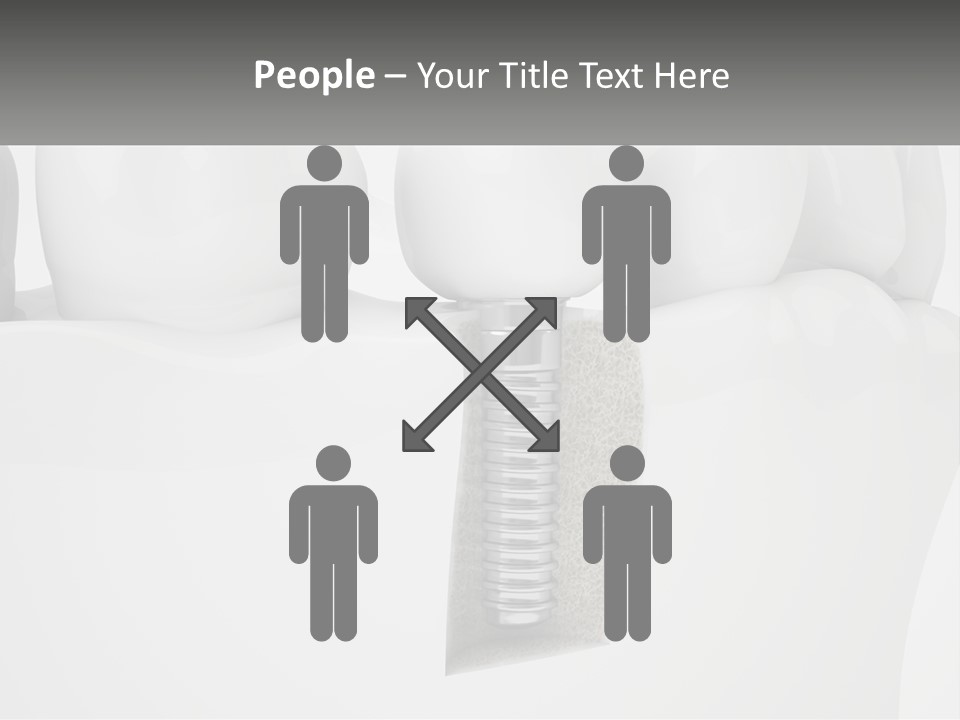 A Tooth With A Dental Implant On Top Of It PowerPoint Template