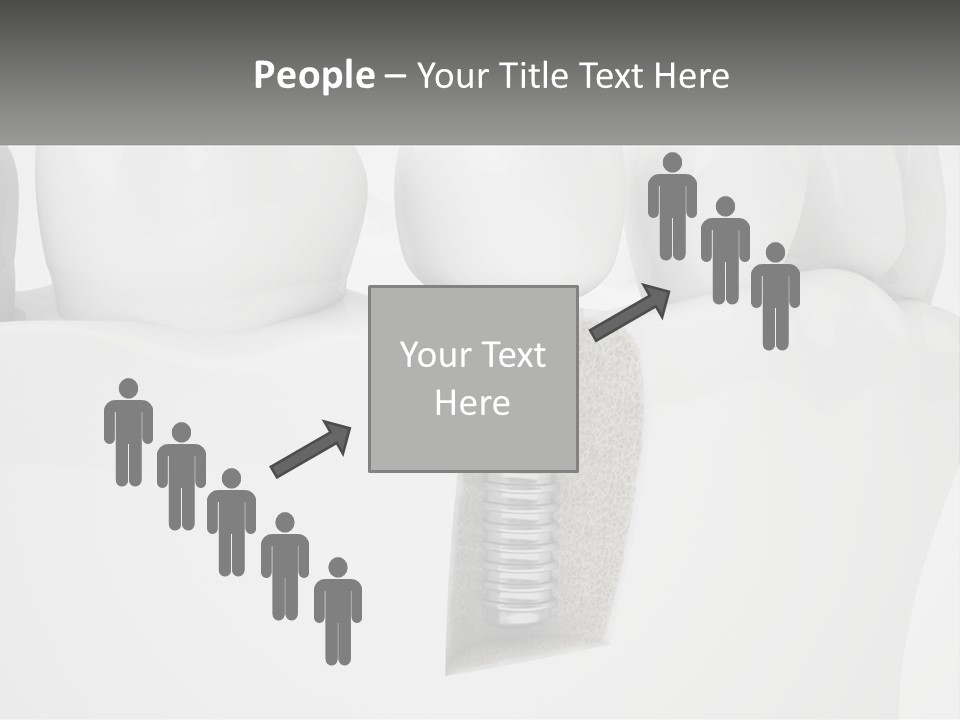 A Tooth With A Dental Implant On Top Of It PowerPoint Template
