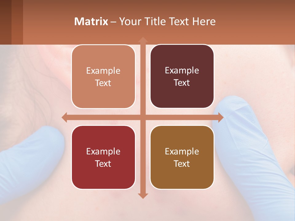 A Woman With Acne On Her Face And Blue Gloves PowerPoint Template