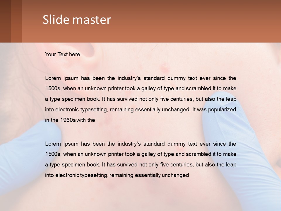 A Woman With Acne On Her Face And Blue Gloves PowerPoint Template