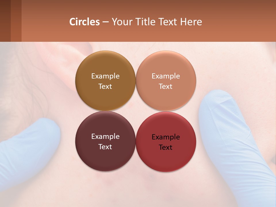 A Woman With Acne On Her Face And Blue Gloves PowerPoint Template