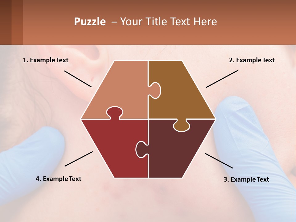 A Woman With Acne On Her Face And Blue Gloves PowerPoint Template