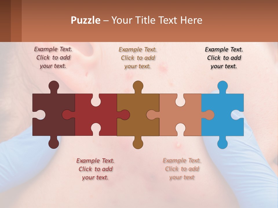 A Woman With Acne On Her Face And Blue Gloves PowerPoint Template