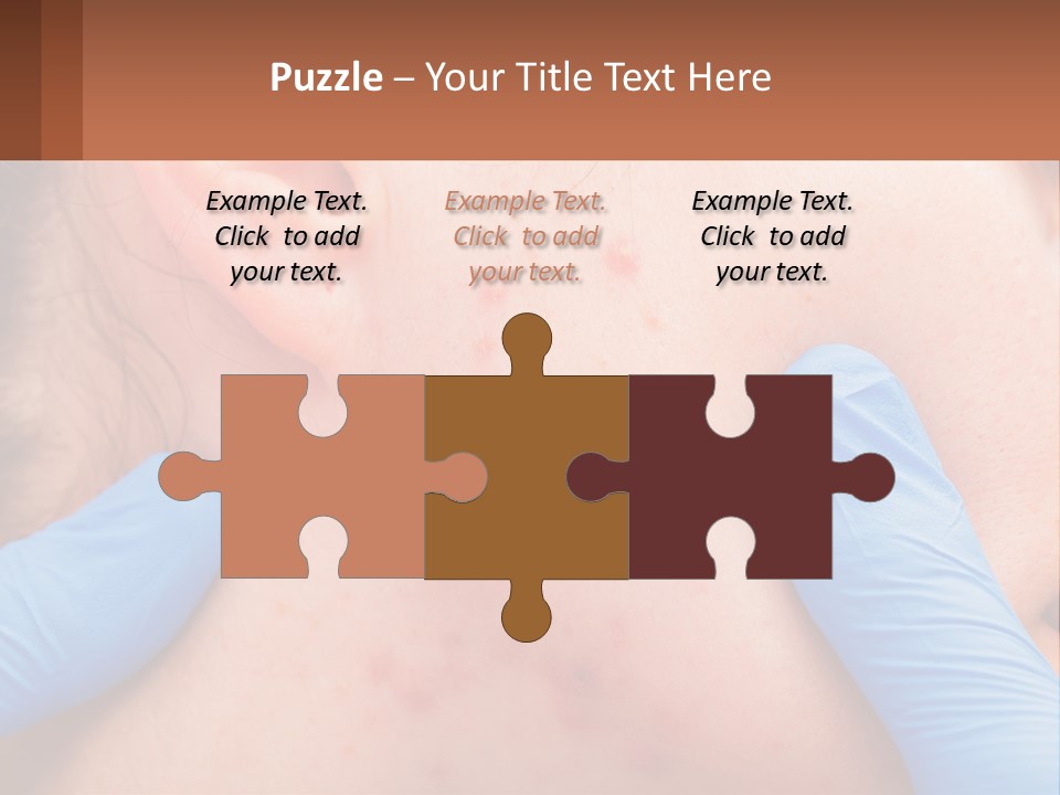 A Woman With Acne On Her Face And Blue Gloves PowerPoint Template