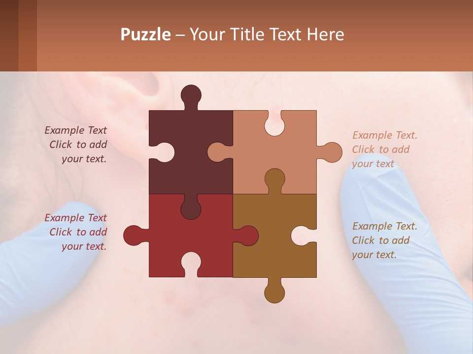 A Woman With Acne On Her Face And Blue Gloves PowerPoint Template