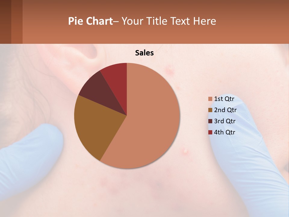 A Woman With Acne On Her Face And Blue Gloves PowerPoint Template