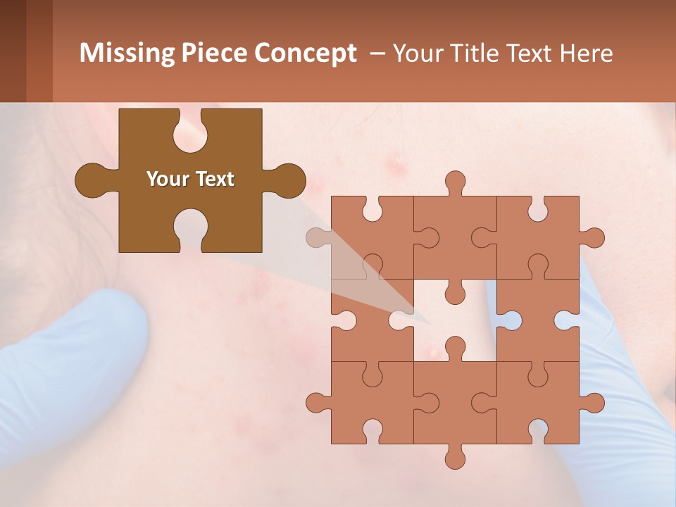 A Woman With Acne On Her Face And Blue Gloves PowerPoint Template