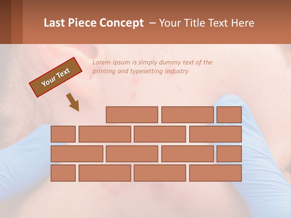 A Woman With Acne On Her Face And Blue Gloves PowerPoint Template