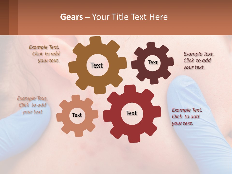 A Woman With Acne On Her Face And Blue Gloves PowerPoint Template