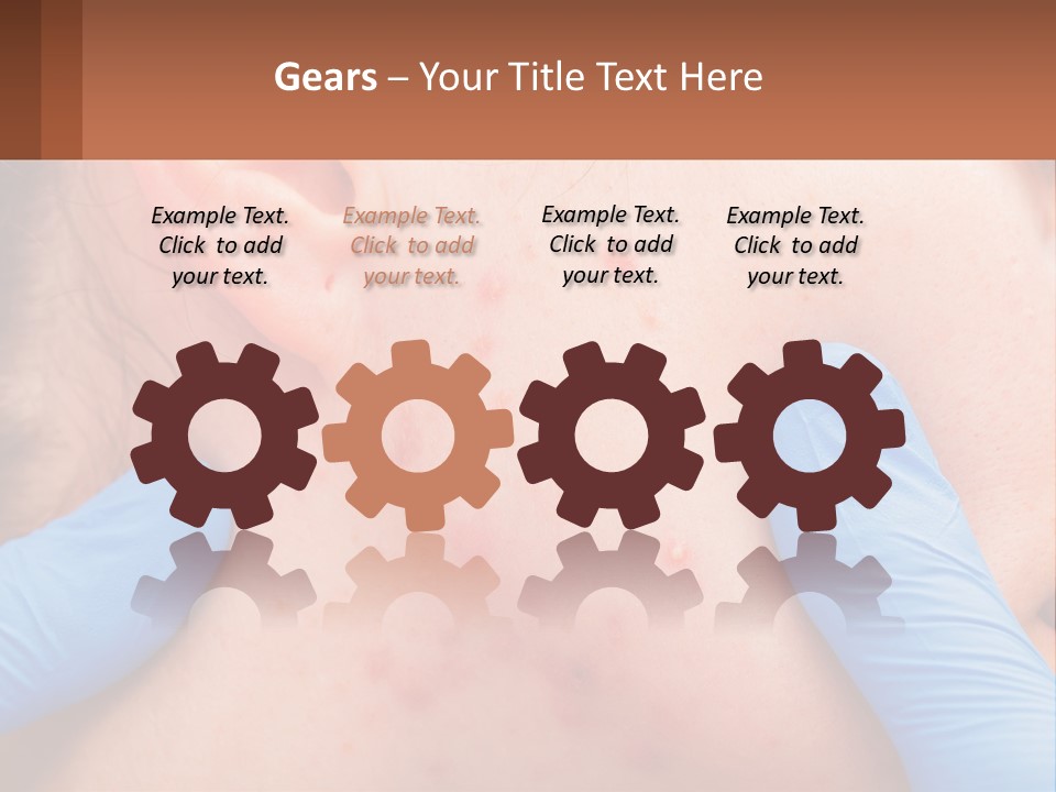 A Woman With Acne On Her Face And Blue Gloves PowerPoint Template