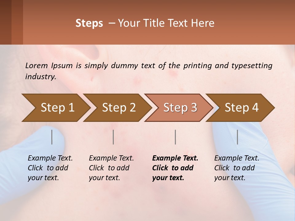 A Woman With Acne On Her Face And Blue Gloves PowerPoint Template