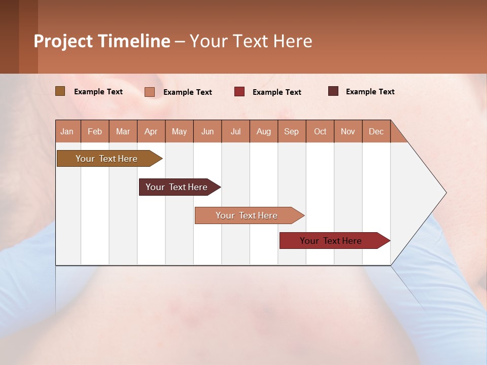 A Woman With Acne On Her Face And Blue Gloves PowerPoint Template