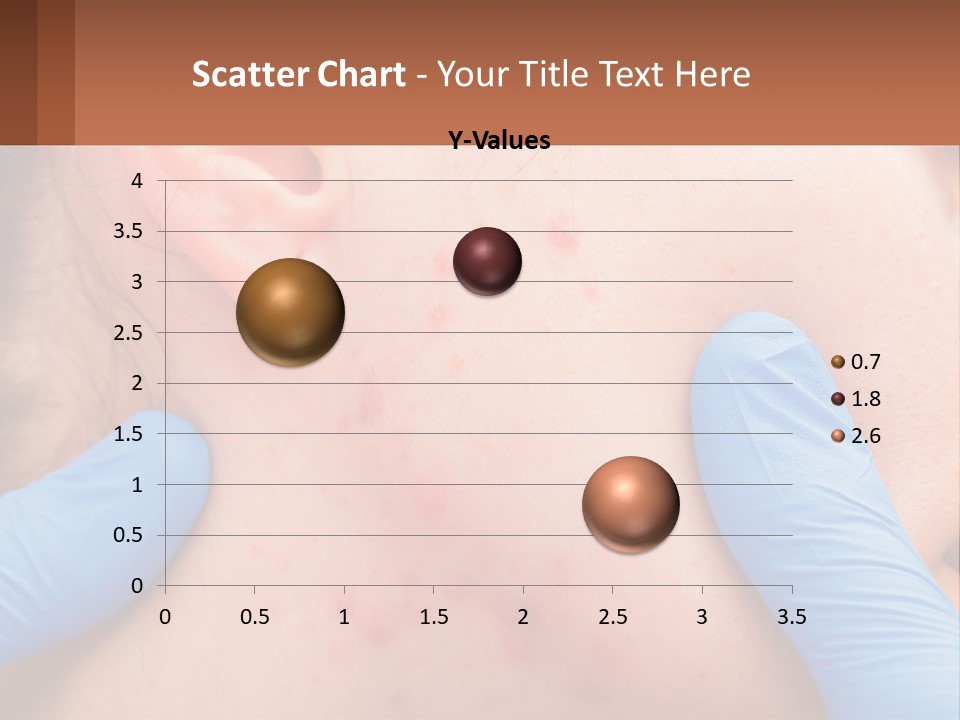 A Woman With Acne On Her Face And Blue Gloves PowerPoint Template