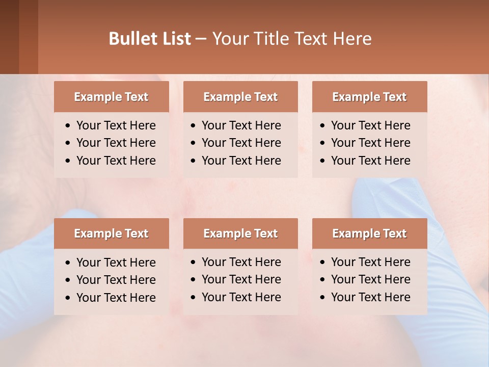 A Woman With Acne On Her Face And Blue Gloves PowerPoint Template