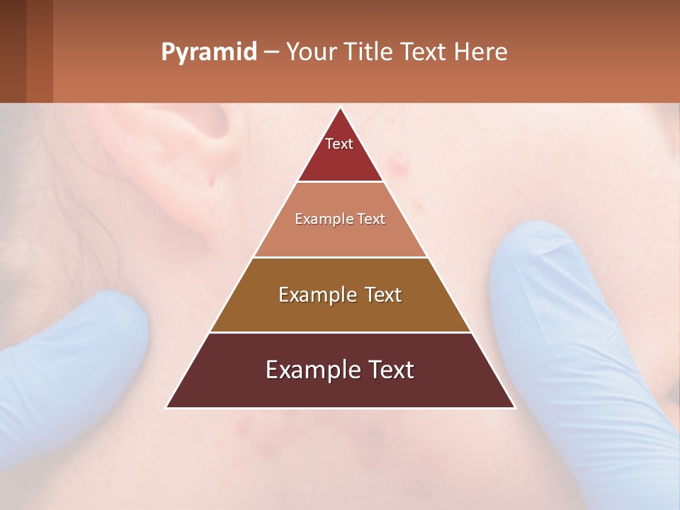 A Woman With Acne On Her Face And Blue Gloves PowerPoint Template