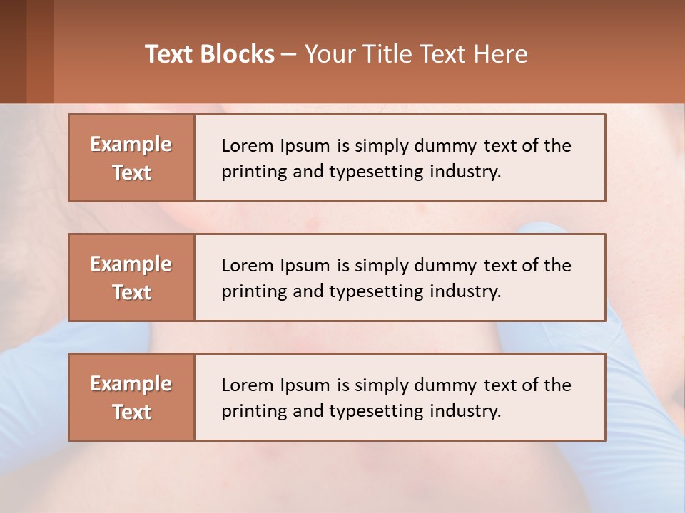 A Woman With Acne On Her Face And Blue Gloves PowerPoint Template