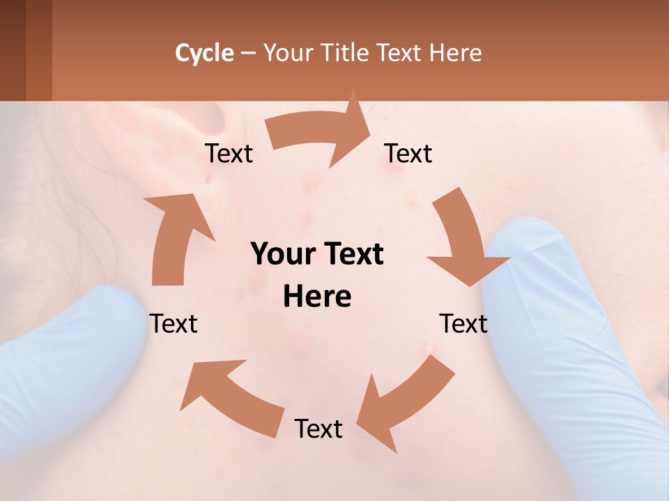 A Woman With Acne On Her Face And Blue Gloves PowerPoint Template