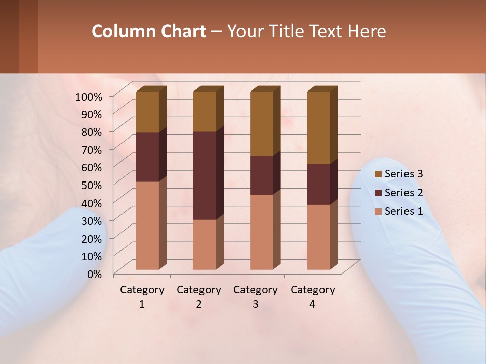 A Woman With Acne On Her Face And Blue Gloves PowerPoint Template