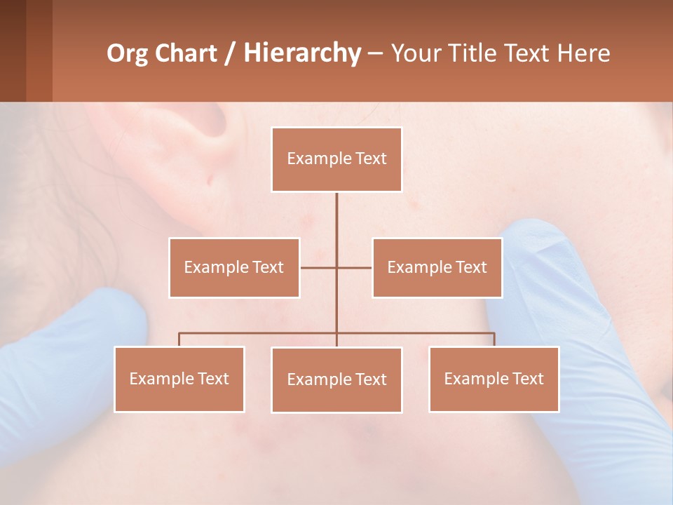 A Woman With Acne On Her Face And Blue Gloves PowerPoint Template