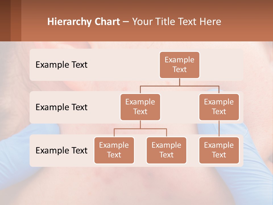 A Woman With Acne On Her Face And Blue Gloves PowerPoint Template