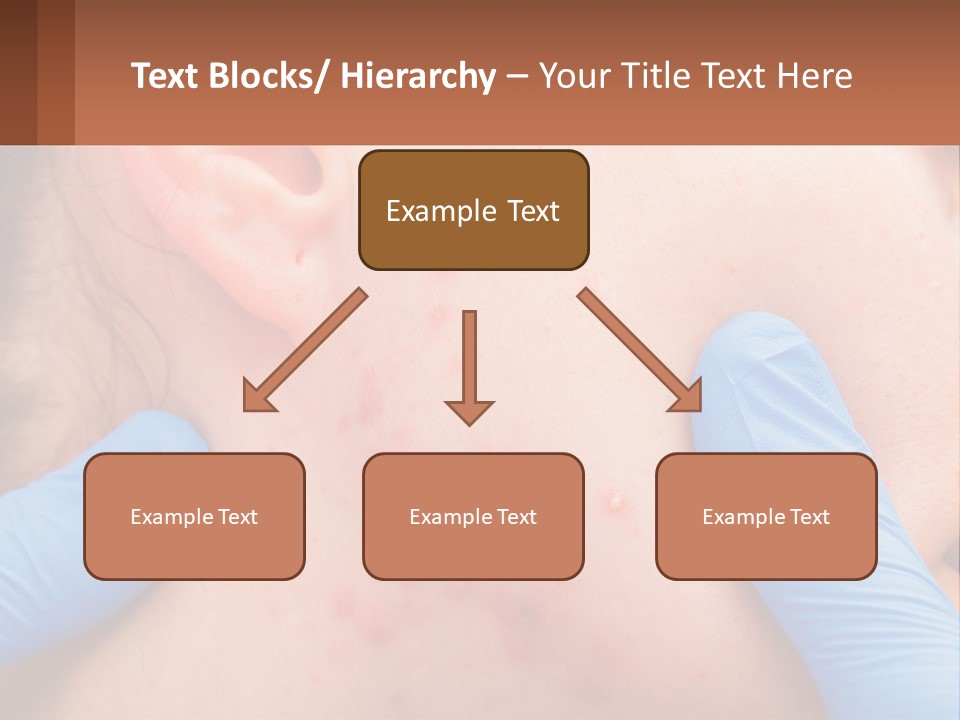 A Woman With Acne On Her Face And Blue Gloves PowerPoint Template